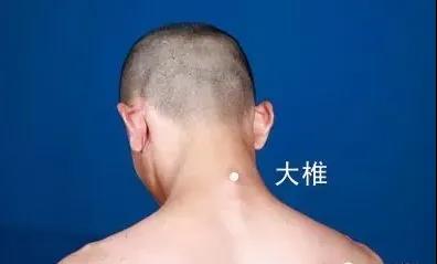 春天灸灸背，能活一百歲~