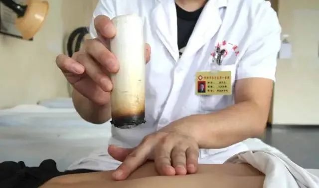 產后艾灸一個月，十年少生病！ 