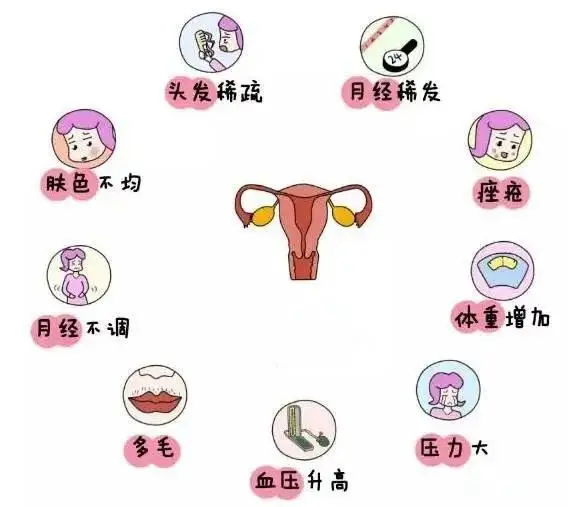10個女人就有1個患多囊！被它纏上不要怕，艾灸幫你調“多囊”！